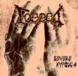 Severe Hypoxia cover