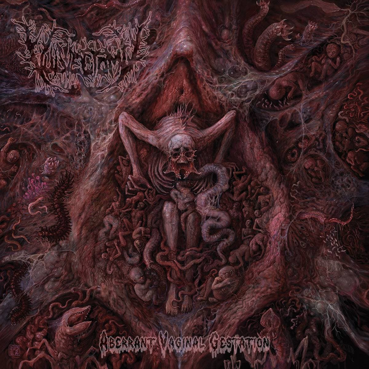 Aberrant Vaginal Gestation cover
