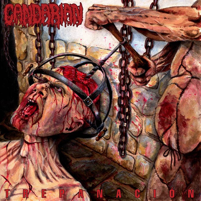 Trepanacion