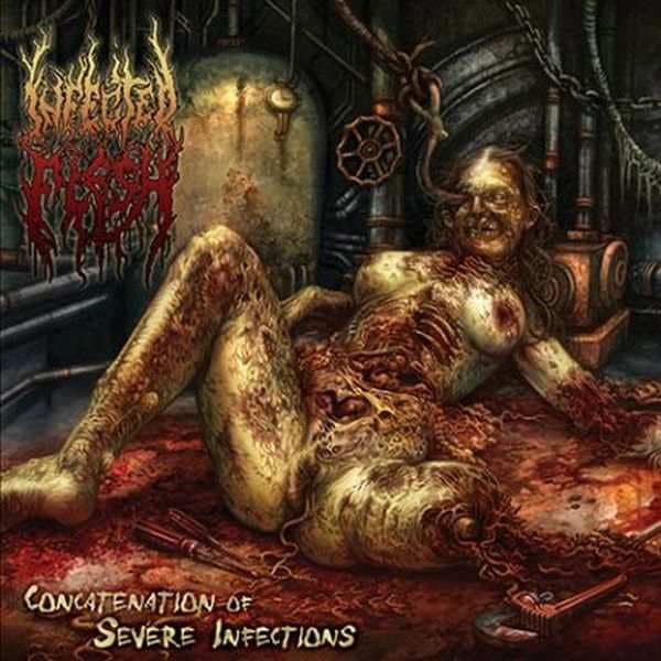 Concatenation of Severe Infections cover